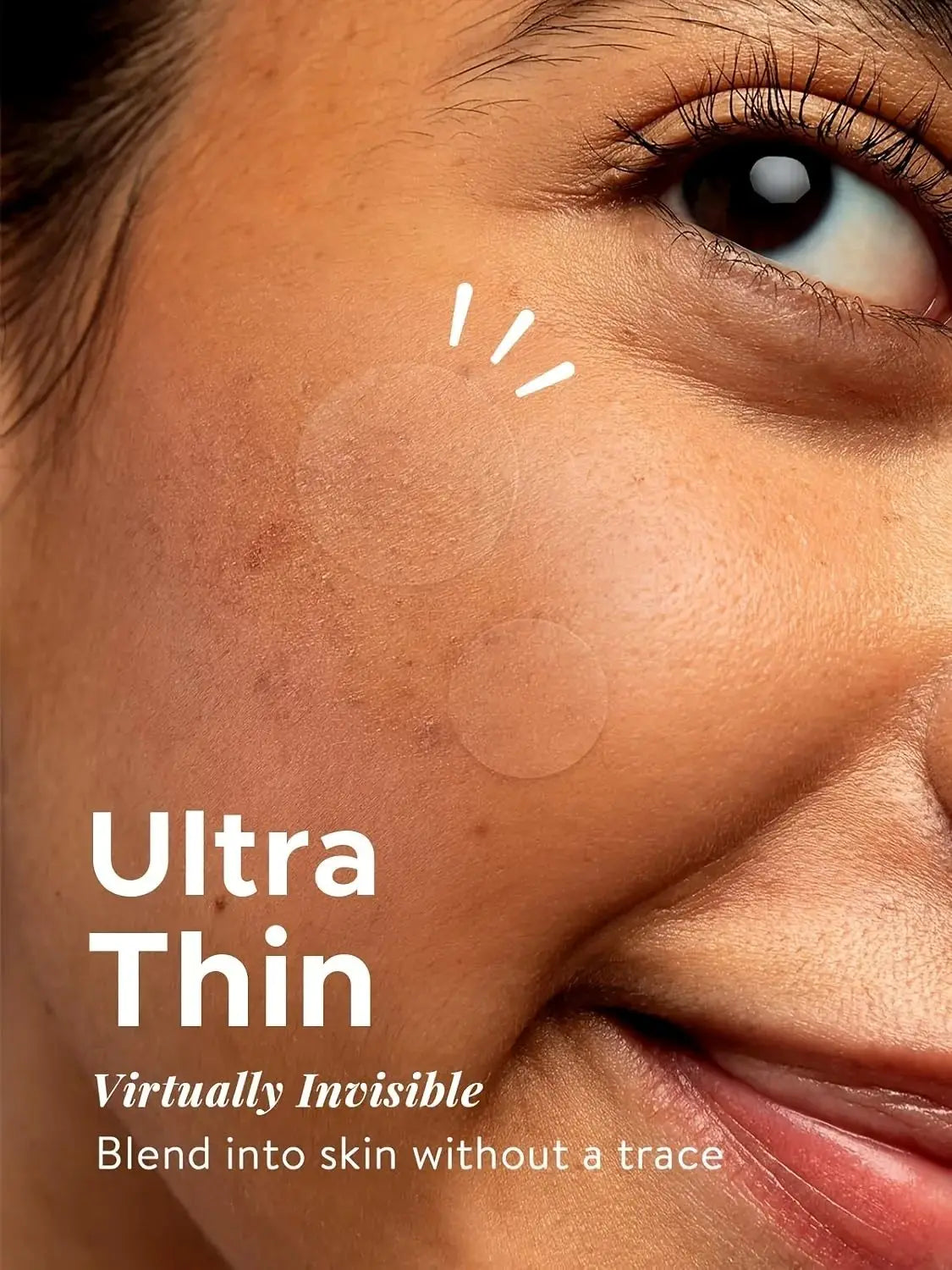 360PCS Invisible Acne Patches – Anti-Inflammatory Pimple Patches for Fast Healing, Absorbing Spot Treatment