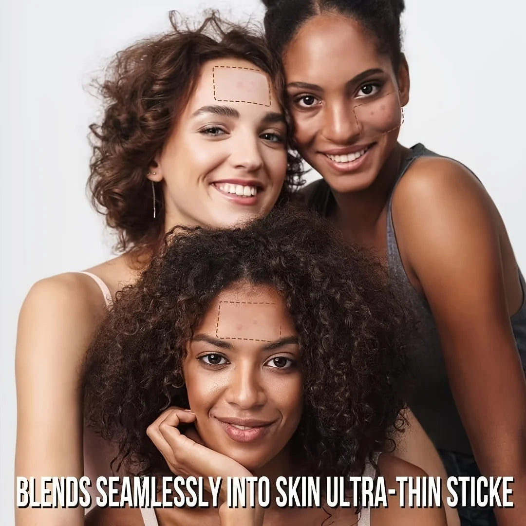 360PCS Invisible Acne Patches – Anti-Inflammatory Pimple Patches for Fast Healing, Absorbing Spot Treatment