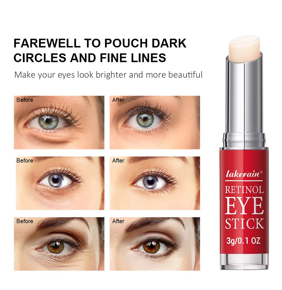 Retinol Eye Cream Stick – Dark Circle Brightening, Firming & Instant Eye Repair for Women